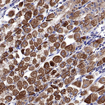 DLAT Rabbit Polyclonal Antibody