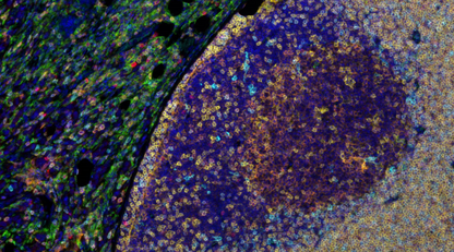Absin 6-Color IHC Kit (Anti-Rabbit and Mouse Secondary Antibody)