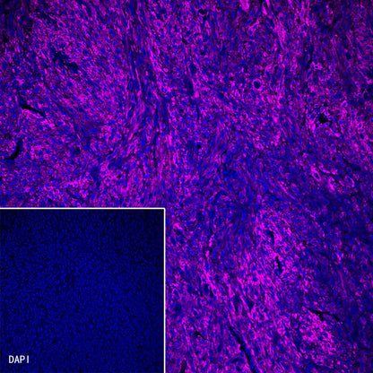 alpha smooth muscle Actin Recombinant Rabbit mAb (Alexa Fluor® 647 Conjugate) (SDT-132-63)