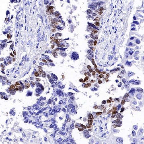 p14ARF Recombinant Rabbit mAb (S-R244)