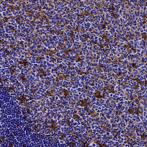 Gelsolin Recombinant Rabbit mAb (S-2522-21)