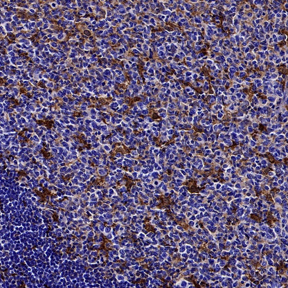 Gelsolin Recombinant Rabbit mAb (S-2522-21)