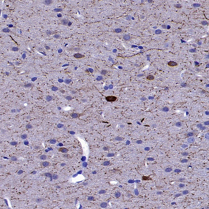 nNOS Recombinant Rabbit mAb (S-1641-70)