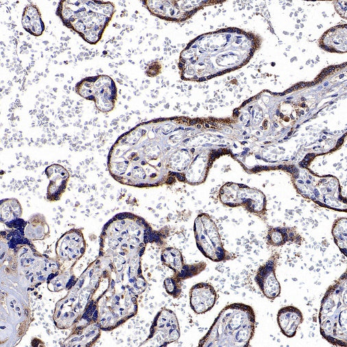 CHMP1a Recombinant Rabbit mAb (S-1651-159)