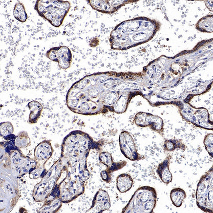 CHMP1a Recombinant Rabbit mAb (S-1651-159)