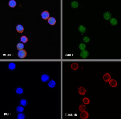 CNOT1 Recombinant Rabbit mAb (S-2273-65)
