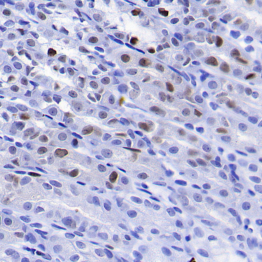 PCNA Recombinant Rabbit mAb (S-5313)