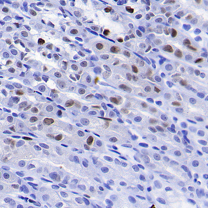 PCNA Recombinant Rabbit mAb (S-5313)