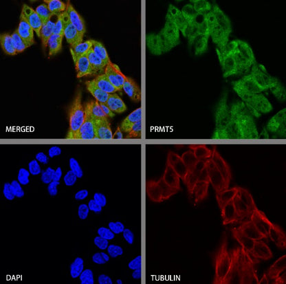 PRMT5 Recombinant Rabbit mAb (S-2336-126)