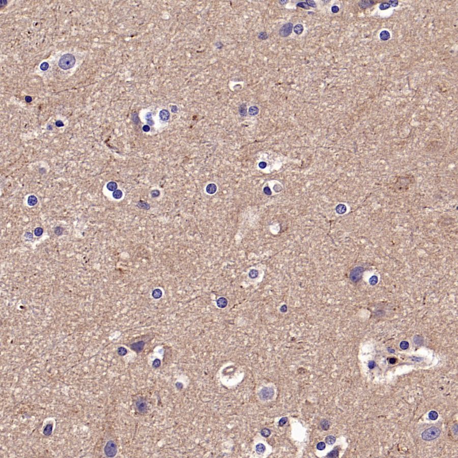 TYK2 Recombinant Rabbit mAb (S-2740-165)