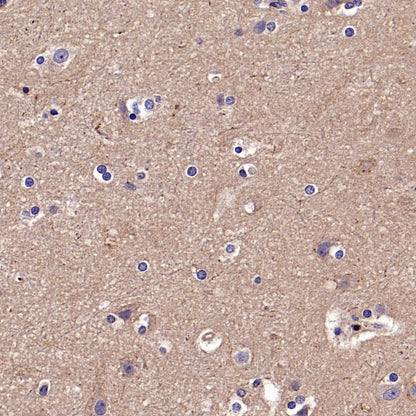TYK2 Recombinant Rabbit mAb (S-2740-165)