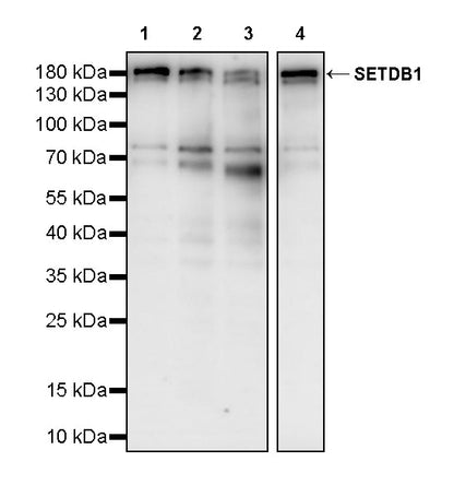SETDB1 Recombinant Rabbit mAb (S-4094-31)