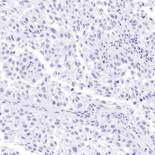 INSM1 Recombinant Rabbit mAb (SDT-3165-72)