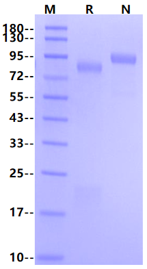 Ebola virus EBOV (subtype Zaire, strain H.sapiens-wt/GIN/2014/Kissidougou-C15) Glycoprotein / GP Protein (His Tag)