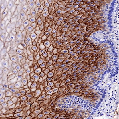 LYPD3/C4.4A Recombinant Rabbit mAb (S-R222)