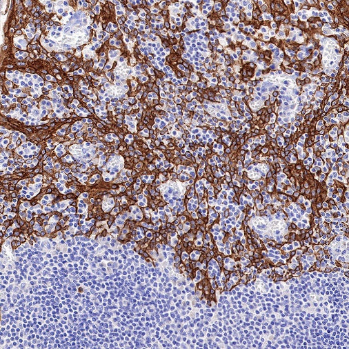 TRIM29 Recombinant Rabbit mAb (S-642-43)