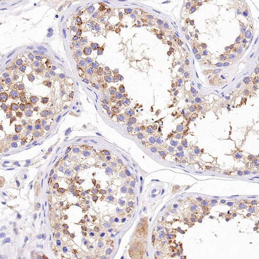 ATG9A Recombinant Rabbit mAb (S-1418-5)