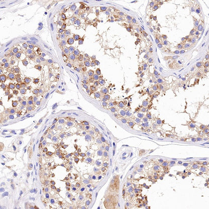ATG9A Recombinant Rabbit mAb (S-1418-5)