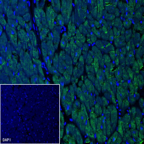 S-RMab® Desmin Recombinant Rabbit mAb (SDT-109-114)