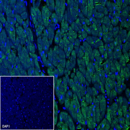 S-RMab® Desmin Recombinant Rabbit mAb (SDT-109-114)