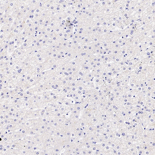 P2ry12 Recombinant Rabbit mAb (SDT-3134-52)