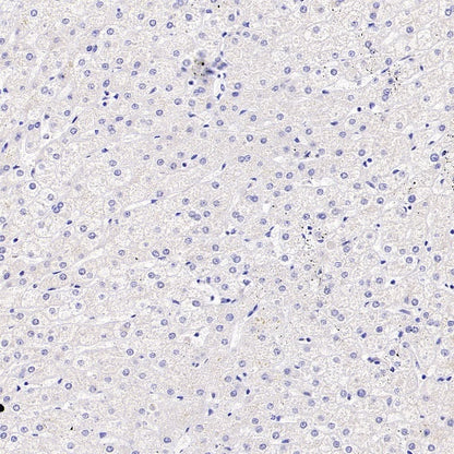 P2ry12 Recombinant Rabbit mAb (SDT-3134-52)