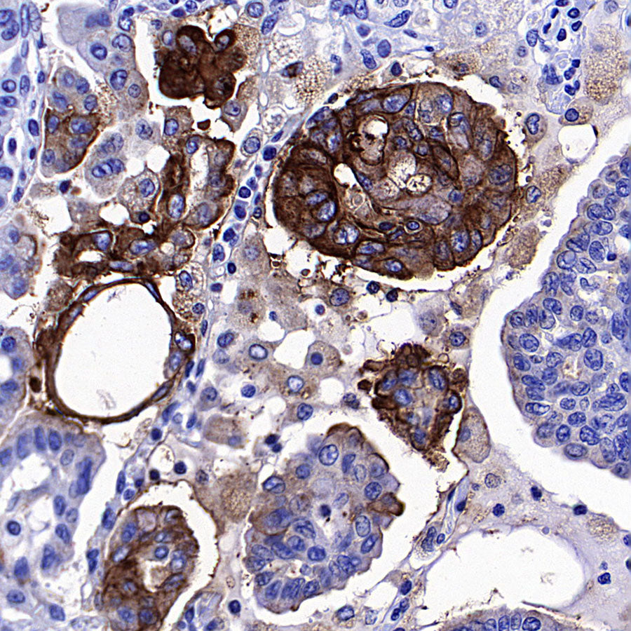 CEA Recombinant Rabbit mAb (SDT-098-41)