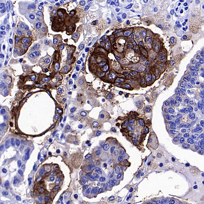 CEA Recombinant Rabbit mAb (SDT-098-41)