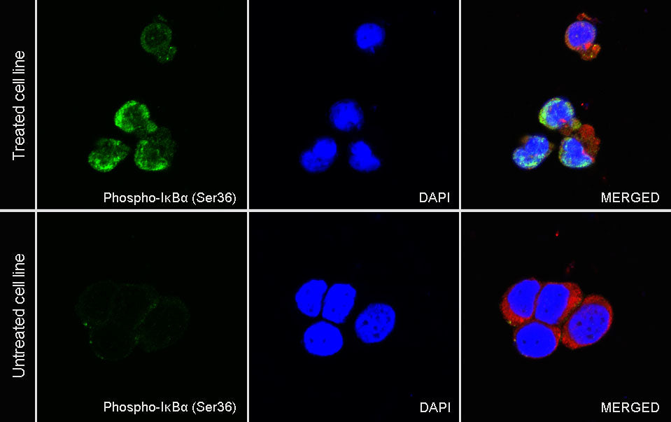Phospho-IκBα (Ser36) Recombinant Rabbit mAb (S-R102)