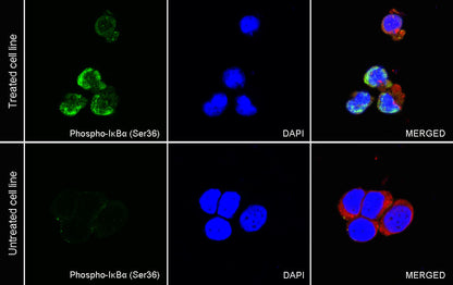 Phospho-IκBα (Ser36) Recombinant Rabbit mAb (S-R102)