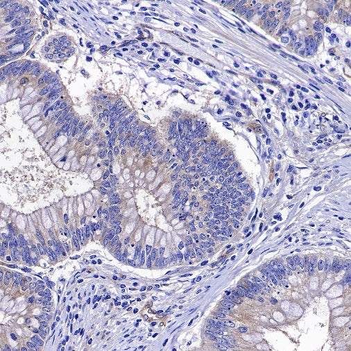 ROCK2 Rabbit Polyclonal Antibody