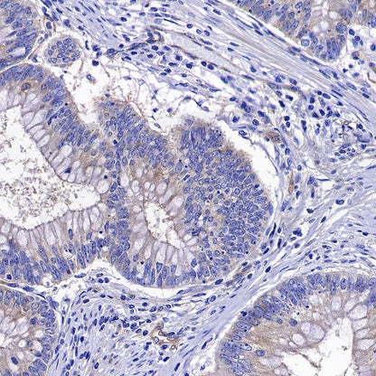 ROCK2 Rabbit Polyclonal Antibody