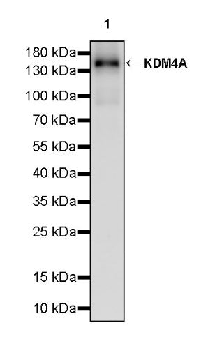 KDM4A Recombinant Rabbit mAb (S-957-138)