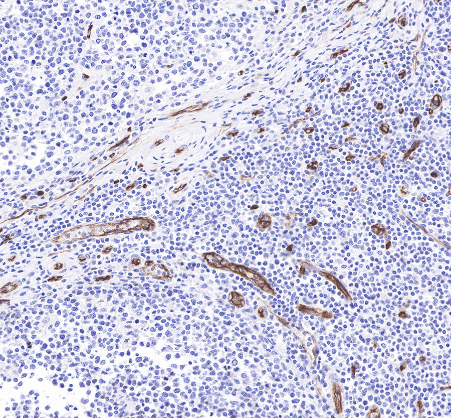 CD34 Recombinant Rabbit mAb,PBS Only (SDT-051-68)