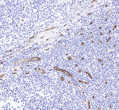 CD34 Recombinant Rabbit mAb,PBS Only (SDT-051-68)