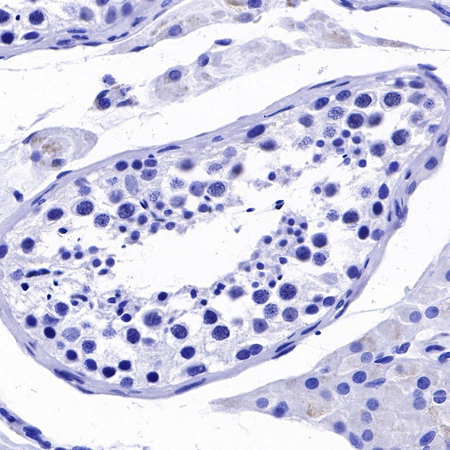 RNA polymerase II CTD repeat YSPTSPS (phosphor S2) Recombinant Rat mAb (S-R199)