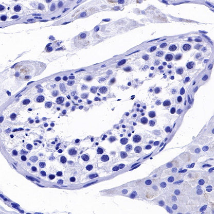 RNA polymerase II CTD repeat YSPTSPS (phosphor S2) Recombinant Rat mAb (S-R199)