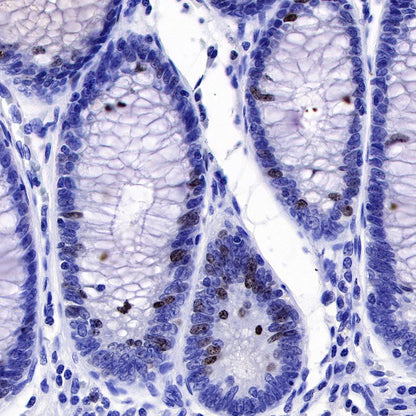 Ki67 Recombinant Mouse mAb (SDT-606-7)