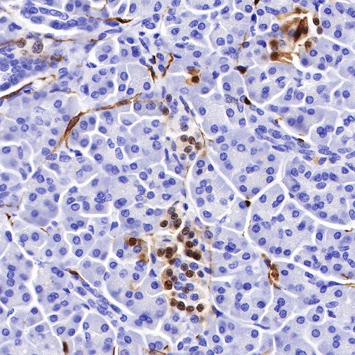 S-RMab® S100B Recombinant Rabbit mAb (SDT-518-45)