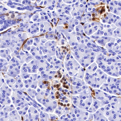 S-RMab® S100B Recombinant Rabbit mAb (SDT-518-45)