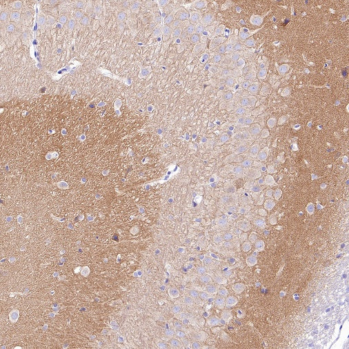 SLC8A1 Recombinant Rabbit mAb (S-3100-17)