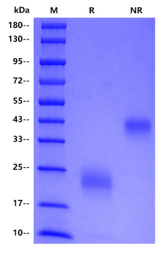 Human FSH alpha&FSH beta/CGA&FSHB protein, No tag&His tag