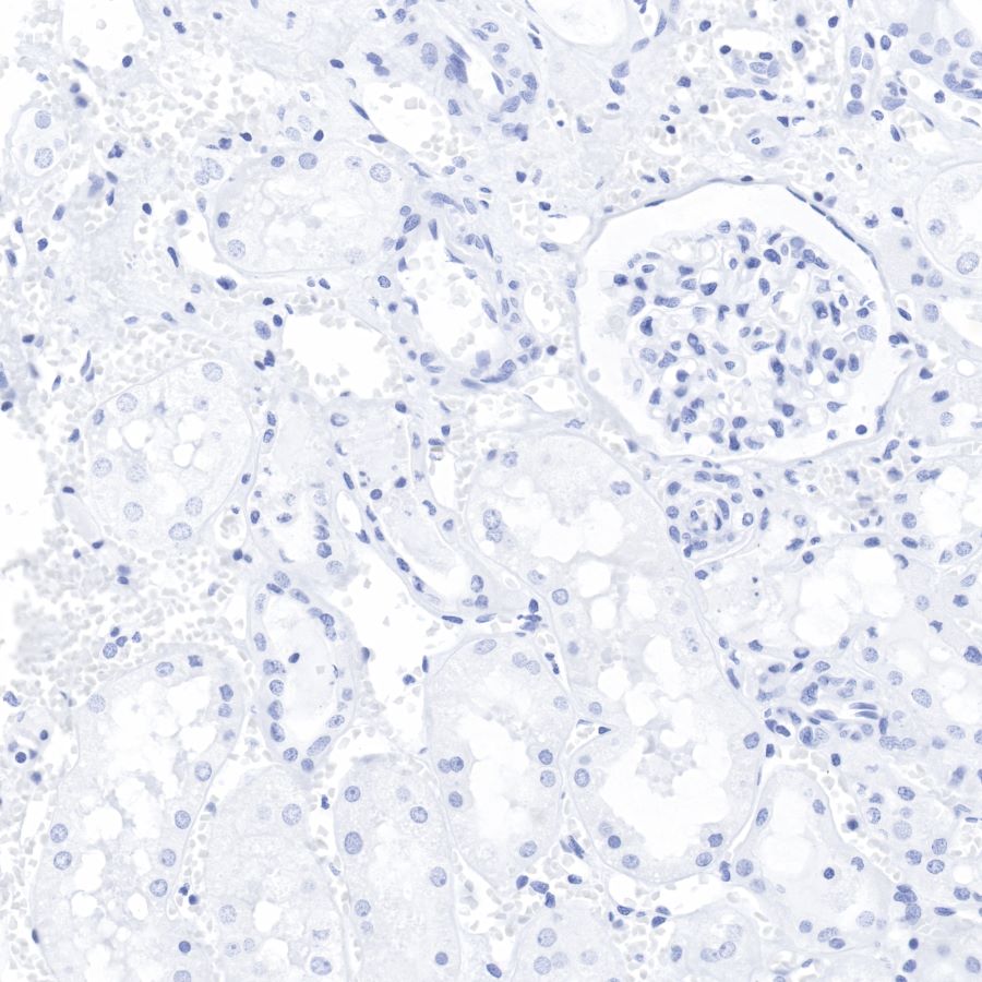 Keratin 20 Recombinant Rabbit mAb (SDT-013-18)