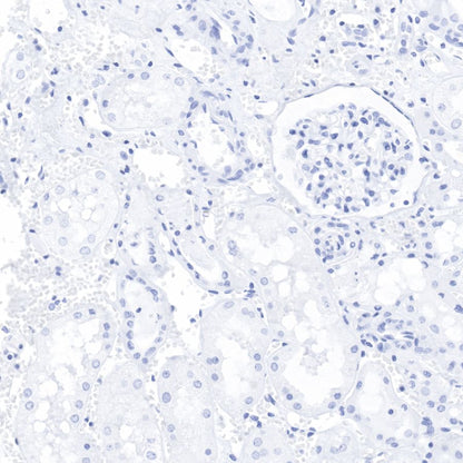 Keratin 20 Recombinant Rabbit mAb (SDT-013-18)