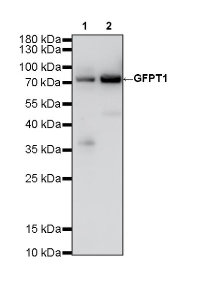 GFPT1 Recombinant Rabbit mAb (S-4752-19)