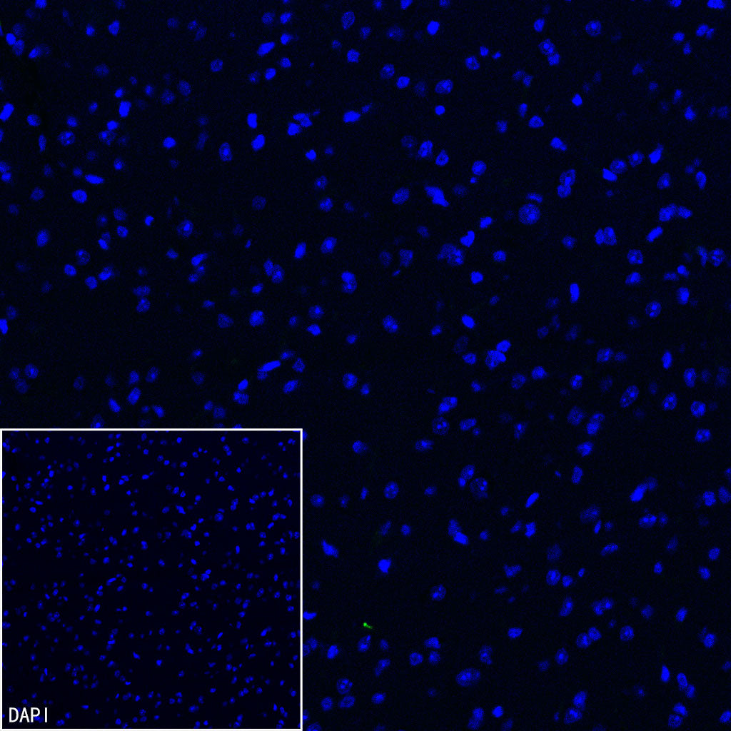 CD206 Recombinant Rabbit mAb (S-3477-27)