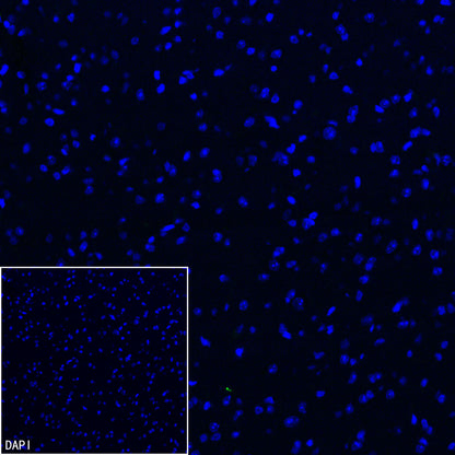 CD206 Recombinant Rabbit mAb (S-3477-27)