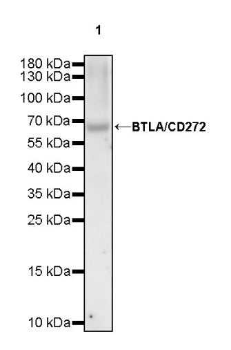 BTLA/CD272 Recombinant Rabbit mAb (S-742-13-2)