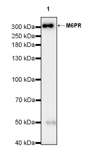 M6PR Recombinant Rabbit mAb (S-2348-14)