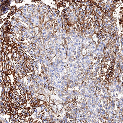 HLA-E Recombinant Rabbit mAb (S-1081-62)